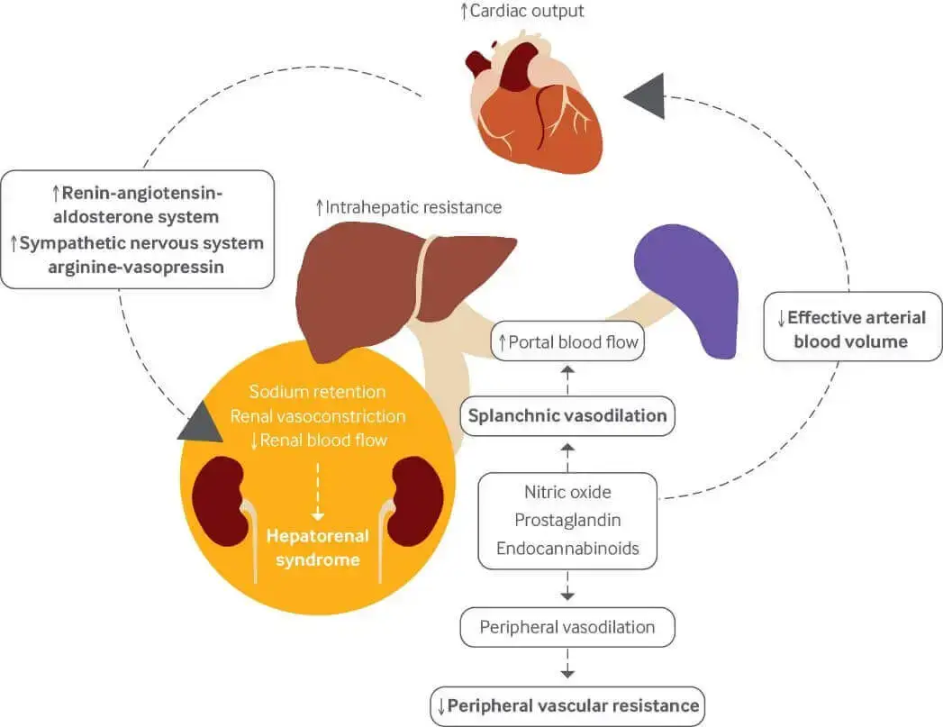 Hepatorenal syndrome Market Report Fig-1