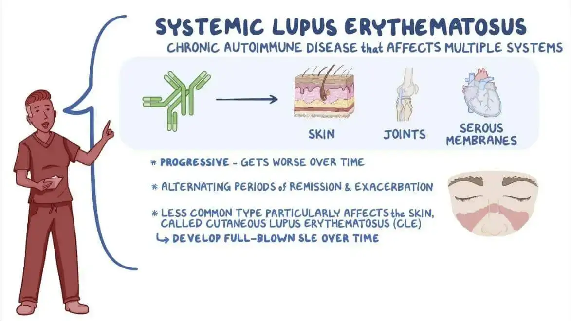 Cutaneous-Lupus-Erythematosus fig -1