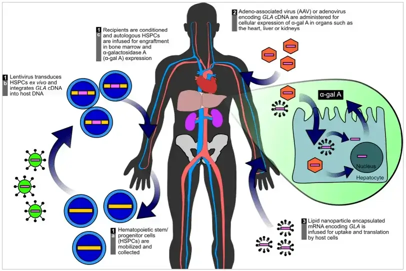 Figure 1 fabry disease