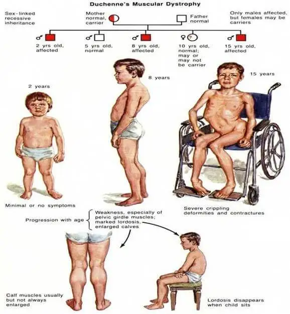 Figure-1 dmd