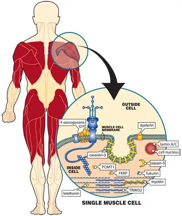  lgmd Figure-1