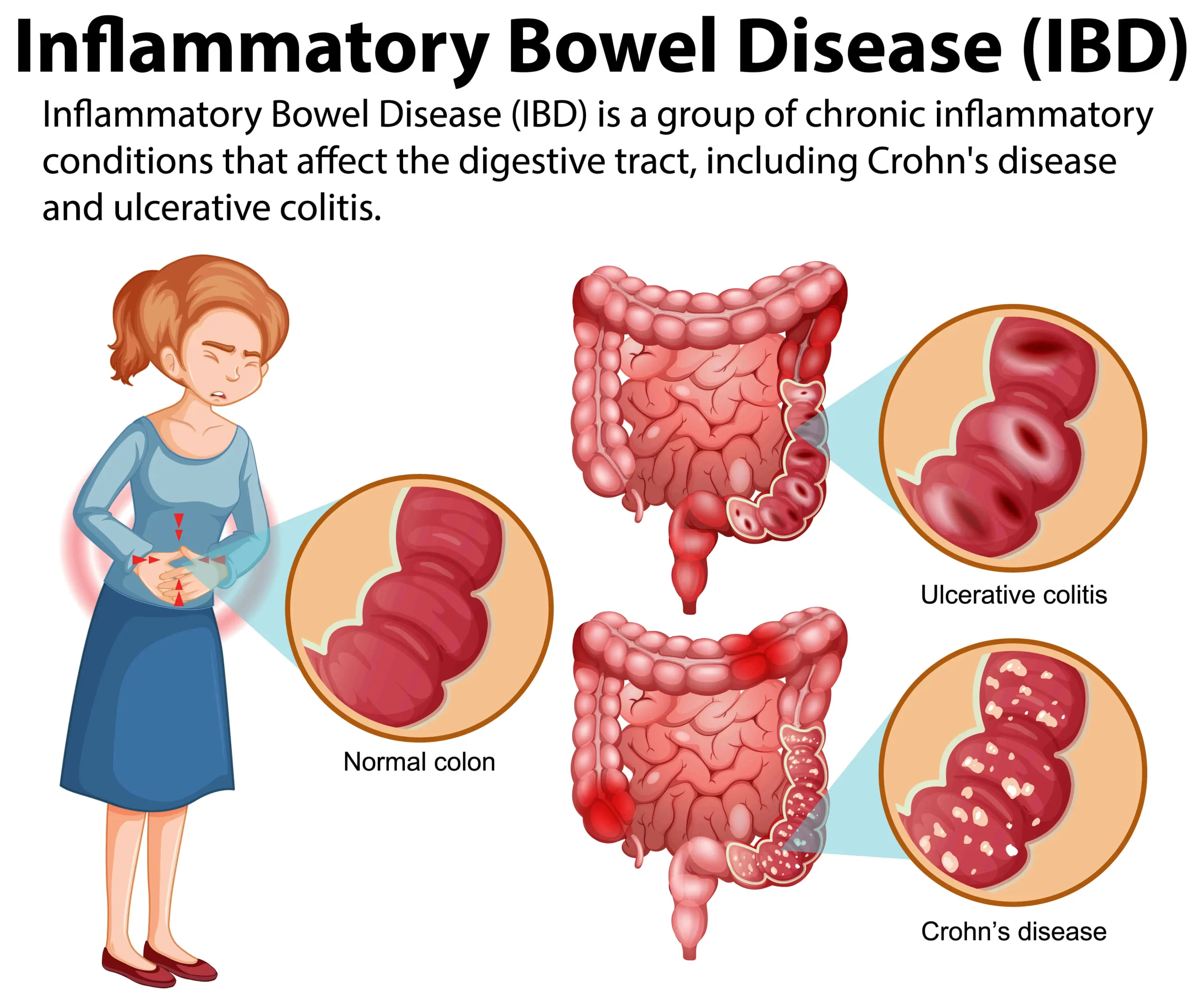 IBD report image